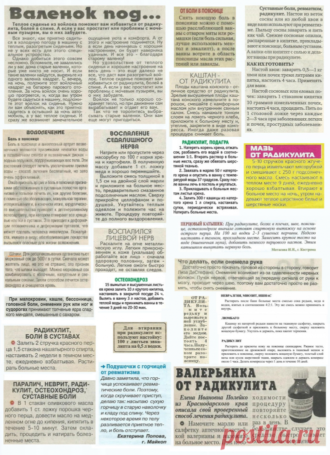 Радикулит