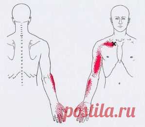 Карта точек напряжения и болей в теле