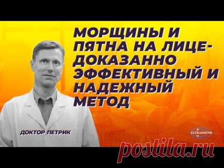 Морщины и пятна на лице. 
Морщины и пигментные пятна на лице появляются при старении кожи.  В этом видео рассказ об эффективном и надежном методе самостоятельного устанения морщин и пятен путем применения геля, который содержит адапален. Этот ретиноид получил одобрение для безрецептурного отпуска в США в 2016 году. 
Адапален очень эффективен в лечении морщин и омоложении кожи. Не все люди чувствуют эффект потому, что слишком рано прекращают лечение, в то время как действие...