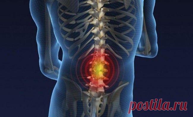 Лечение межпозвоночной грыжи народными методами