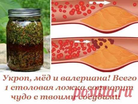 Укроп, мёд и валериана! Всего 1 столовая ложка сотворит чудо с твоими сосудами.

К сожалению, наши кровеносные сосуды имеют свойство загрязняться. Они накапливают на своих стенках отложения неорганических солей, что в дальнейшем является причиной развития атеросклероза, нарушения кровообращения, повышенного давления и варикоза.

Поэтому рекомендуется регулярно проводить курс очищения кровеносной системы. Сегодня наша редакция поделится с тобой проверенным методом очищения ...