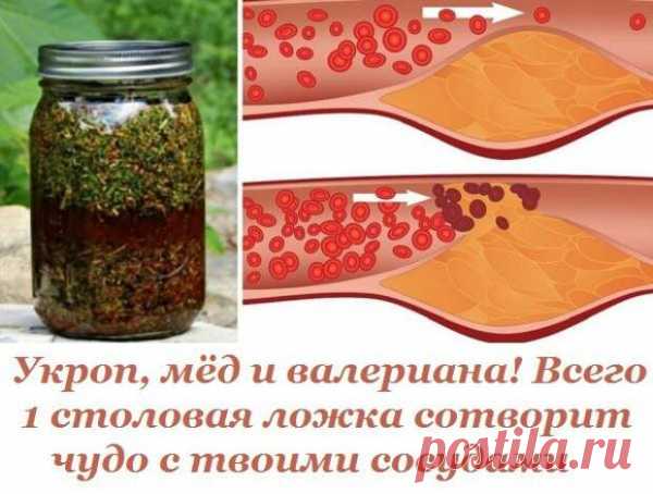 Укроп, мёд и валериана! Всего 1 столовая ложка сотворит чудо с твоими сосудами.