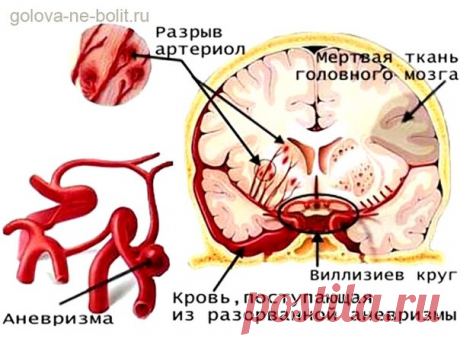 НАРОДНЫЕ СРЕДСТВА ДЛЯ УЛУЧШЕНИЯ МОЗГОВОГО КРОВООБРАЩЕНИЯ 

Нарушение мозгового кровообращения 

Гипертония и атеросклероз — две основные причины, приводящие к нарушению мозгового кровообращения. 
Показать полностью…