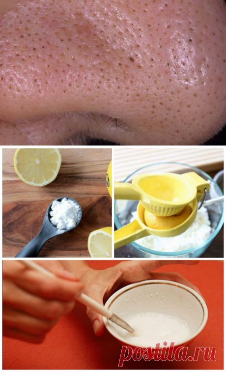 Больше никаких мучительных походов к косметологу! Хитрый трюк для избавления от черных точек. - Современная леди