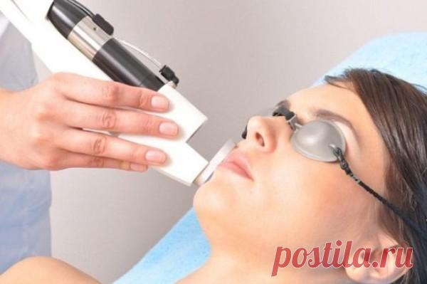 Эпиляция усиков лазером у женщин: видео-инструкция как удалить своими руками, фотоэпиляция, электроэпиляция, фото и цена