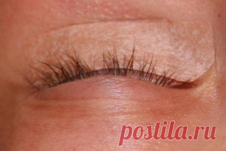 Лечение ресниц в домашних условиях: видео-инструкция по уходу своими руками, как вылечить гипотрихоз, перхоть, гниды, вши у ребенка, что делать, если волоски опалились, болят у корней, цена, фото