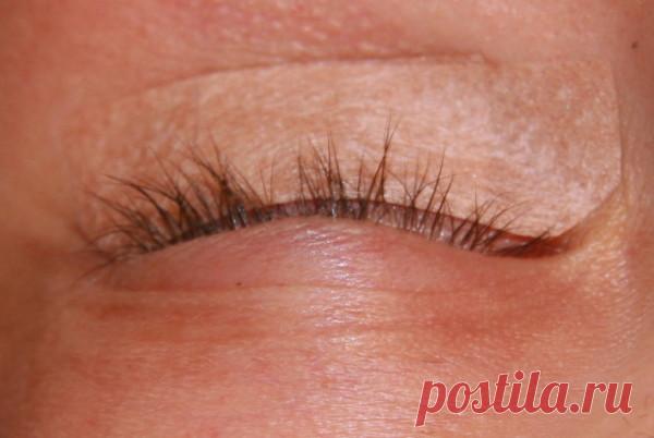 Лечение ресниц в домашних условиях: видео-инструкция по уходу своими руками, как вылечить гипотрихоз, перхоть, гниды, вши у ребенка, что делать, если волоски опалились, болят у корней, цена, фото