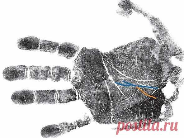 Как узнать о болезнях по руке: секреты хиромантии | Красота внутри вас | Яндекс Дзен