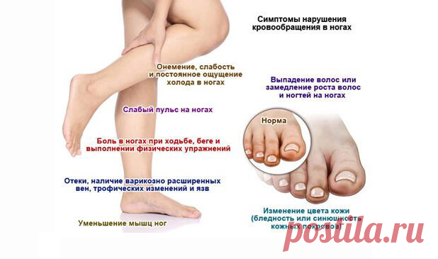 Плохое КРОВООБРАЩЕНИЕ в ногах - как проявляется + эффективные методы