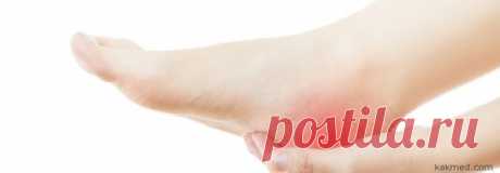 Лечение пяточной шпоры в домашних условиях народными средствами: 7 лучших рецептов