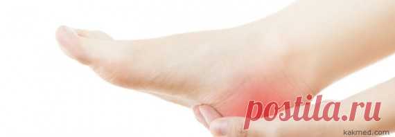 Лечение пяточной шпоры в домашних условиях народными средствами: 7 лучших рецептов