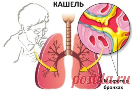 Лечение кашля народными средствами быстро у взрослого