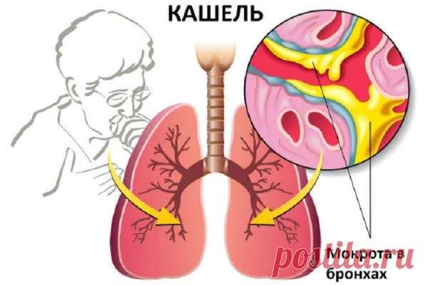 Лечение кашля народными средствами быстро у взрослого