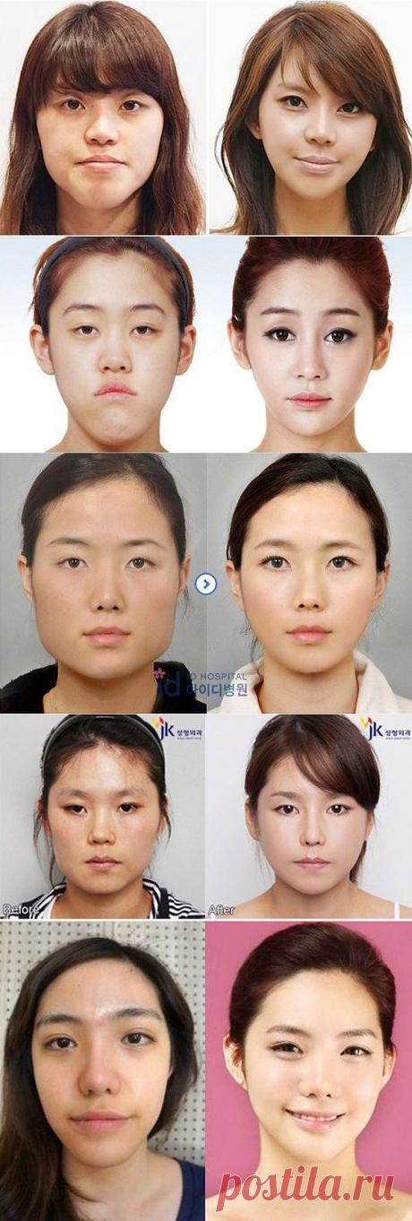Пластическая хирургия в Южной Корее