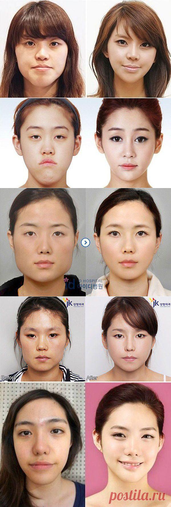 Пластическая хирургия в Южной Корее