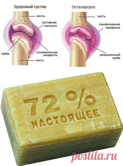Болят колени, лечение народными средствами..