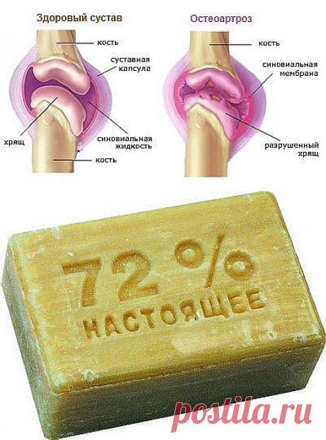 Болят колени, лечение народными средствами..