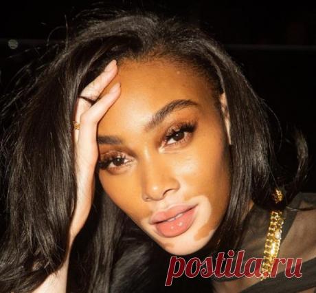 ТОП-5 женщин с необычной внешностью, ломающих все стереотипы о стандартах красоты