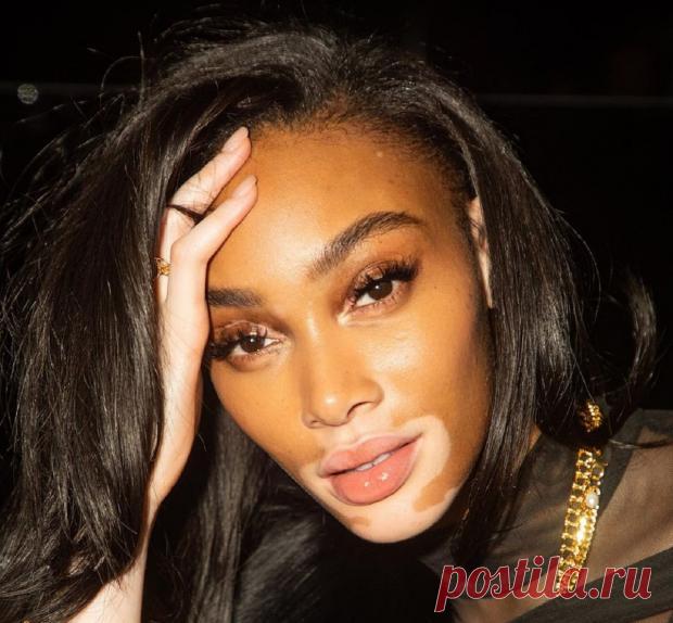 ТОП-5 женщин с необычной внешностью, ломающих все стереотипы о стандартах красоты