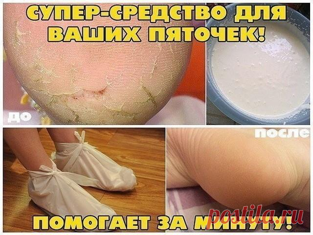 ВОЛШЕБНОЕ СРЕДСТВО ДЛЯ ВАШИХ ПЯТОЧЕК. ЭФФЕКТ ПОТРЯСАЮЩИЙ!
