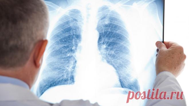 В Китае, США и Европе растет число заболевших пневмонией детей. В Китае, США, Дании, Франции и Нидерландах растет число случаев заболеваемости пневмонией у детей от 5 до 12 лет. Болезнь вызывают бактерии Mycoplasma pneumoniae, сообщает телеканал CNN. Китайские медики сообщают о перегруженности клиник ...