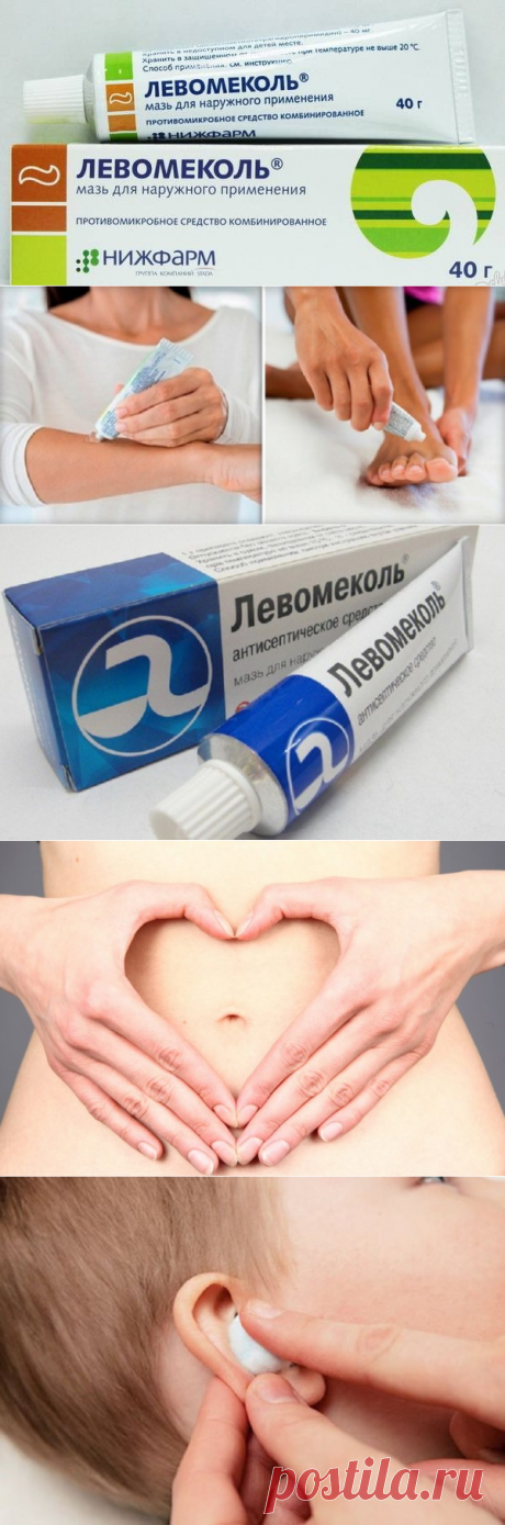 7 способов применения мази «Левомеколь» / Будьте здоровы