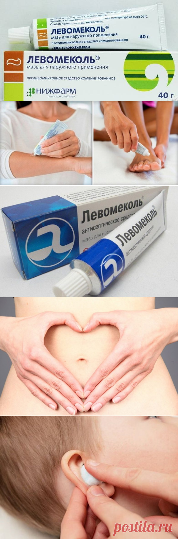 7 способов применения мази «Левомеколь» / Будьте здоровы