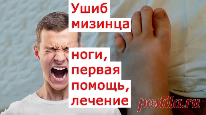 Ушибы пальцев ног — одна из самых распространенных травм, с которыми сталкивались многие из Вас. Чаще всего ушиб пальца на ноге возникает из-за неосторожности, когда мы случайно задеваем посторонние предметы. Наверное, чаще всего травмируется мизинец на ноге. В результате такого ушиба появляется сильная боль, отек, гематома. Это может быстро пройти, но иногда такая травма очень болезненна