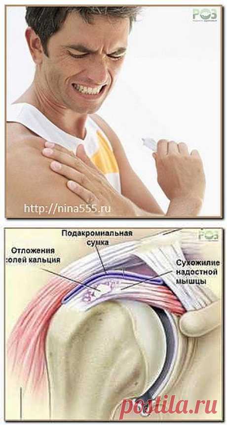сообщение русалла : Доктор, у меня сильно болит плечевой сустав! (10:43 13-11-2013) [4651240/299427318] - natasha_5656@mail.ru - Почта Mail.Ru