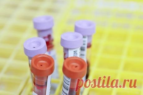 Разработан одновременный на ВИЧ и туберкулез экспресс-тест. Команда исследователей из Медицинской школы Университета Тулейна разработали экспресс-тест, который может диагностировать одновременно ВИЧ и туберкулез на основе антигенов заболеваний. Новый анализ требует лишь небольшого количества крови — 200 микролитров, что равно примерно нескольким каплям.