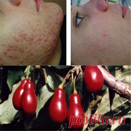 Эти ягоды спасают миллионы людей от самого коварного недуга! Быстрая регенерация тканей организма… - Женские Мелочи