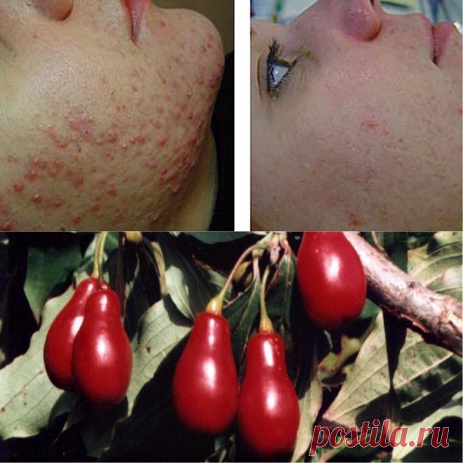Эти ягоды спасают миллионы людей от самого коварного недуга! Быстрая регенерация тканей организма… - Женские Мелочи