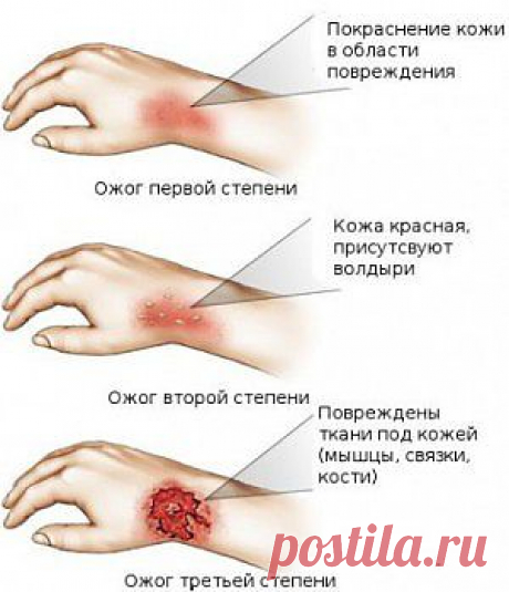 Темы дня: КАК ЛЕЧАТ ОЖОГИ В НАРОДЕ.; Как вырастить мандарин из...; 5 лучших народных рецептов от... и многое другое - rkhal@mail.ru - Почта Mail.Ru