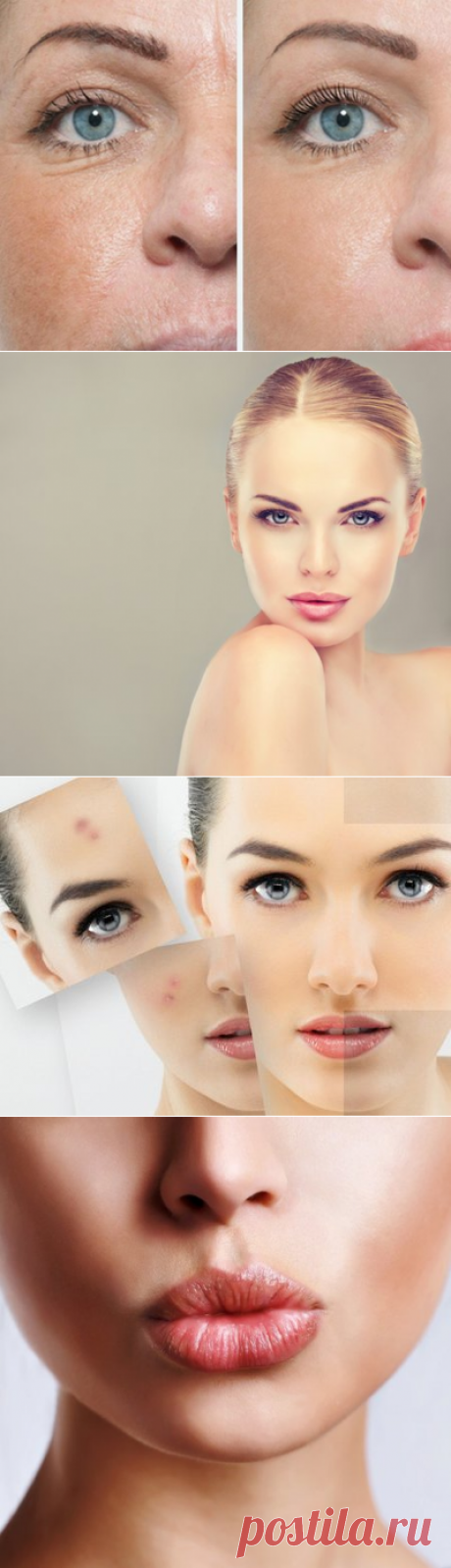 Салициловый пилинг в домашних условиях