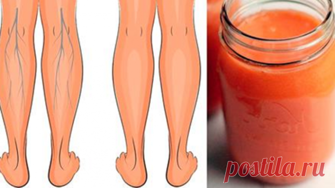 Эти соки эффективно укрепляют вены, улучшают кровообращение в ногах, и устраняют отёки! Невероятно, но они действительно работают! Уже через неделю ушли все отёки и ноги перестали быстро уставать! У большинства людей есть проблемы с