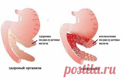 Топ-7 продуктов, которые нужно есть, чтобы исцелить свою поджелудочную железу Стоит добавить эти продукты в свой ежедневный рацион! Большинство людей беспокоятся о здоровье своего сердца, легких или даже их желудка. Но никто не