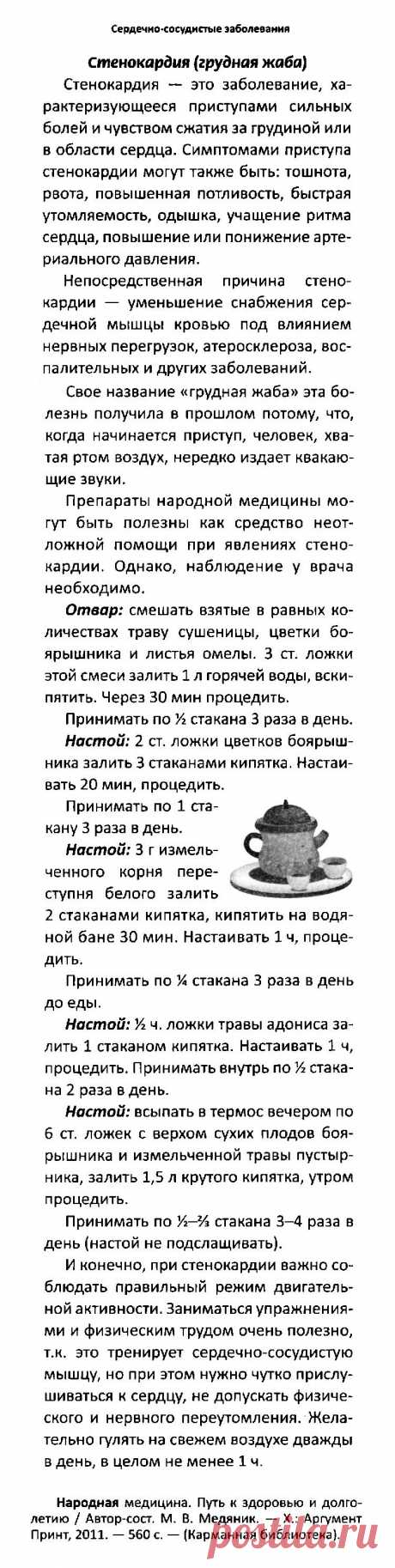 Стенокардия (грудная жаба)