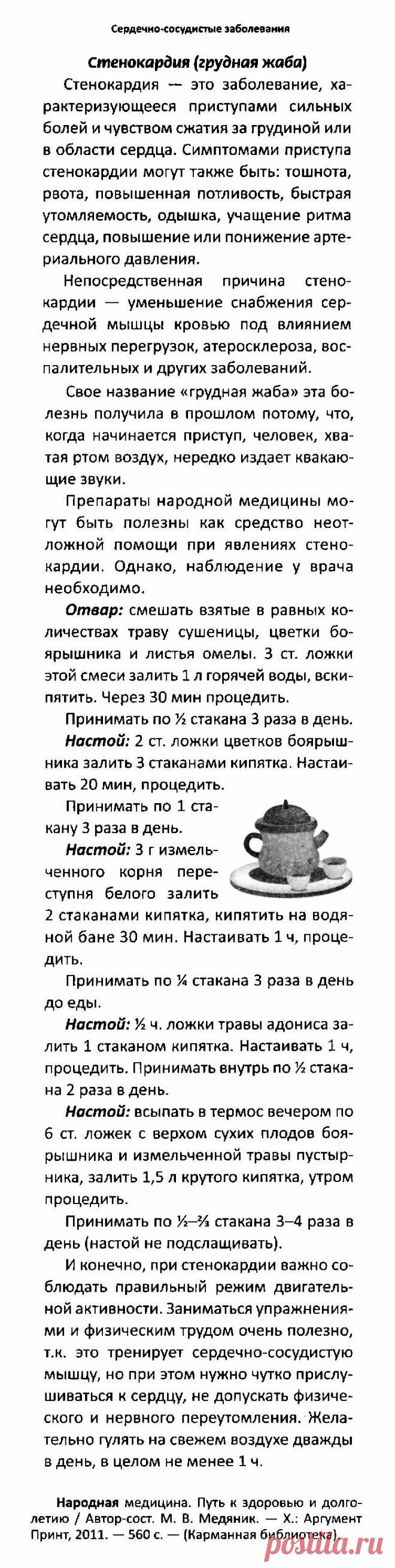 Стенокардия (грудная жаба)