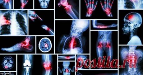 Всі хвороби – від придушення емоцій! Ось приклади на конкретних внутрішніх органах Ви вірите в зв’язок душі і тіла, в те, що думки та почуття проявляються фізично? Цілителі споконвіку кажуть про невідчутну нитку, яка пов’язує наш фізичний організм з емоційним станом. Одна з них — Луїза Хей, автор бестселера «Зціли своє життя». «Я з любов’ю прислухаюся до сигналів свого тіла», — каже вона. Хей закликає всіх прислухатися […]