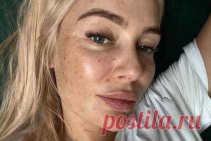 Актриса Рудова показала лицо без фильтров со следами от инъекций. Российская актриса театра и кино Наталья Рудова показала внешность без фильтров со следами от инъекций на коже после посещения косметолога. На размещенном снимке звезда продемонстрировала крупным планом лицо без макияжа, на котором видны коричневые пятна — следы от уколов коллагена и препарата «Курасен».