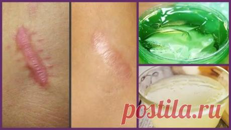 Лечение пораженных участков кожи.