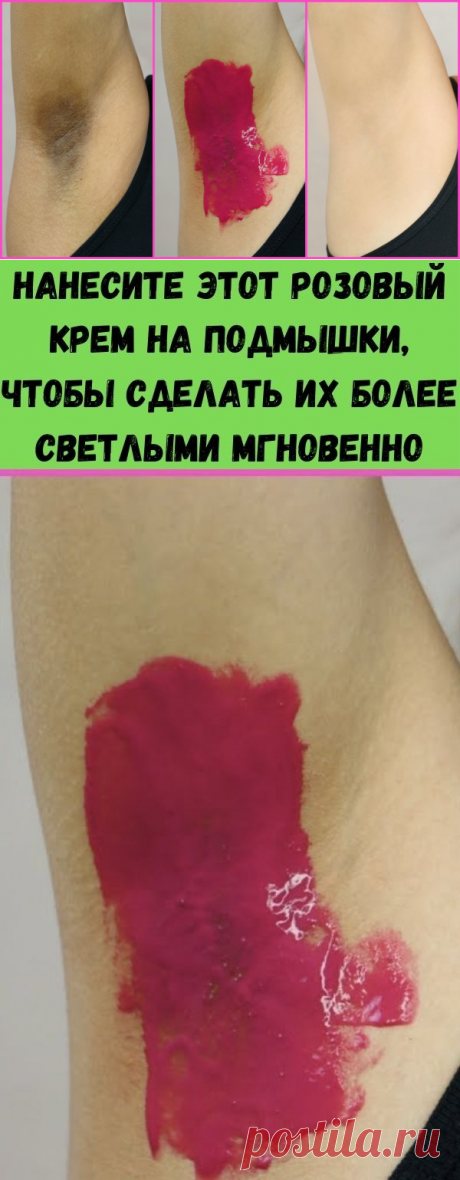 Нанесите этот розовый крем на подмышки, чтобы сделать их более светлыми мгновенно - Полезные советы красоты