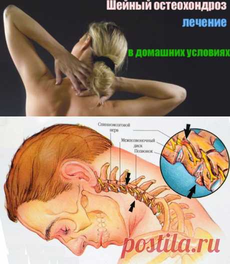7 ПРОСТЫХ УПРАЖНЕНИЙ ДЛЯ ЛЕЧЕНИЯ ОСТЕОХОНДРОЗА ШЕЙНОГО ОТДЕЛА ПОЗВОНОЧНИКА | Кому за пятьдесят