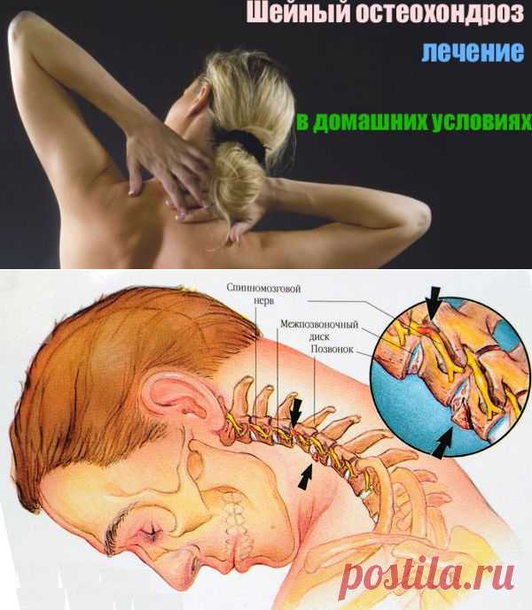 7 ПРОСТЫХ УПРАЖНЕНИЙ ДЛЯ ЛЕЧЕНИЯ ОСТЕОХОНДРОЗА ШЕЙНОГО ОТДЕЛА ПОЗВОНОЧНИКА | Кому за пятьдесят