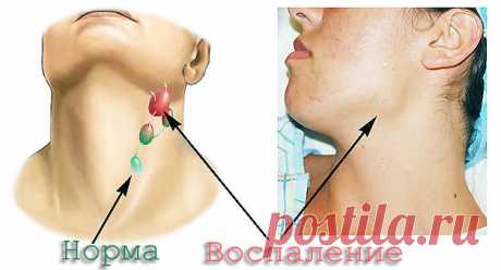 Лимфатическая система. Мифы и реальность