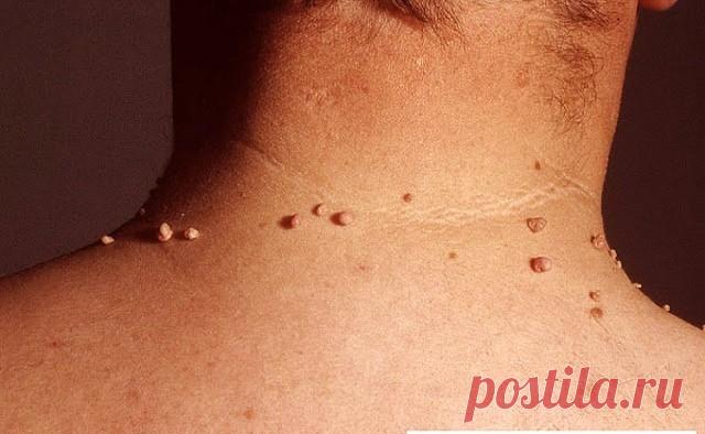 (48) Одноклассники