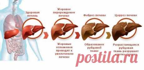 Мягкое очищении печени по методике Андреаса Морица