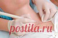 Старческая кератома: лечение народными средствами | Golbis