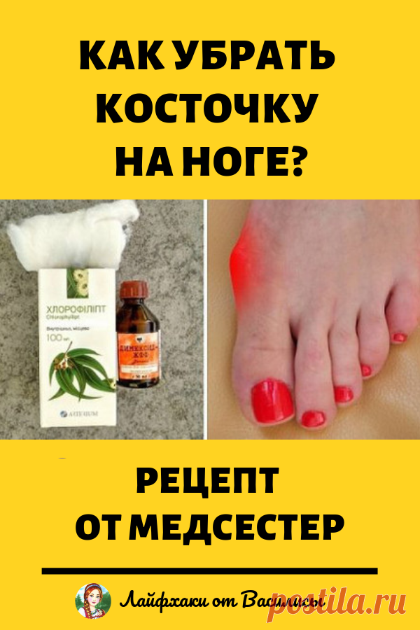 Как убрать косточку на ноге. Рецепт от медсестер. Красота и здоровье в домашних условиях