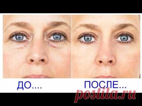 Как избавиться от темных кругов за 4 дня - YouTube